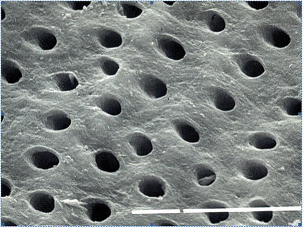 Dientes al microscopio
