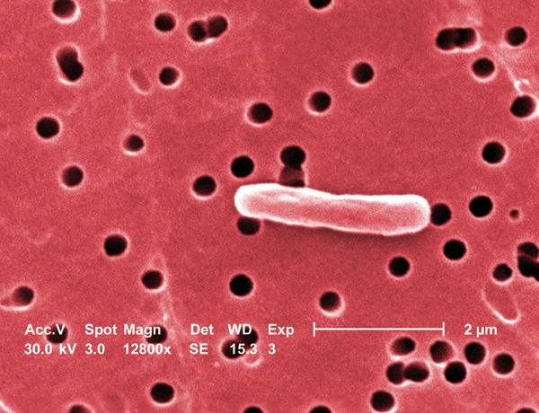 A Escherichia coli produz 90% das cistite.